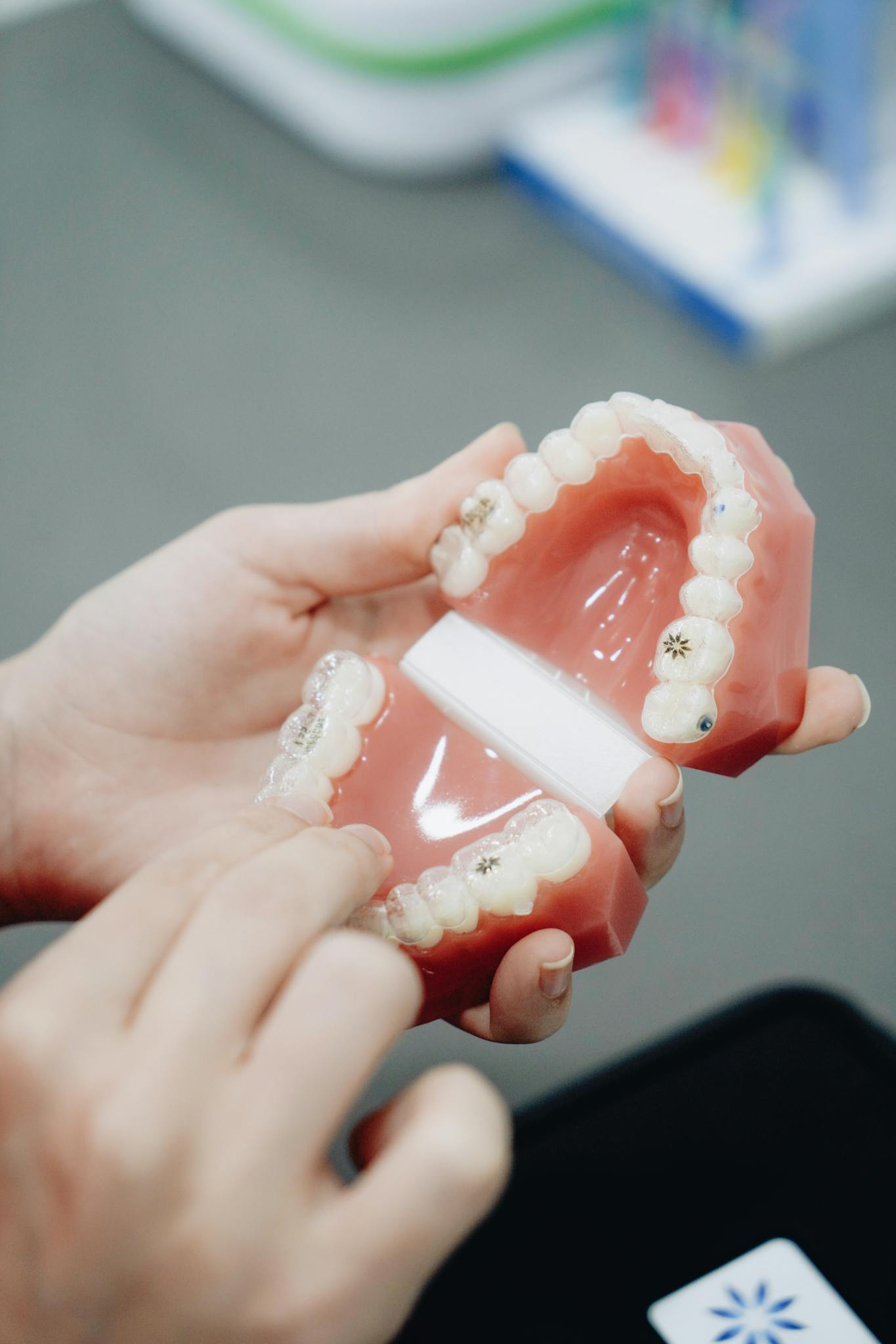 Close-up of hands holding and examining a dental cast with orthodontic brackets.